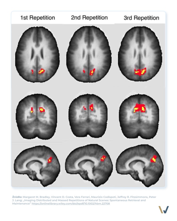Trzy skany fMRI mózgu pokazujące rosnącą aktywność neuronalną podczas kolejnych powtórzeń tego samego materiału w procesie uczenia i konsolidacji pamięci