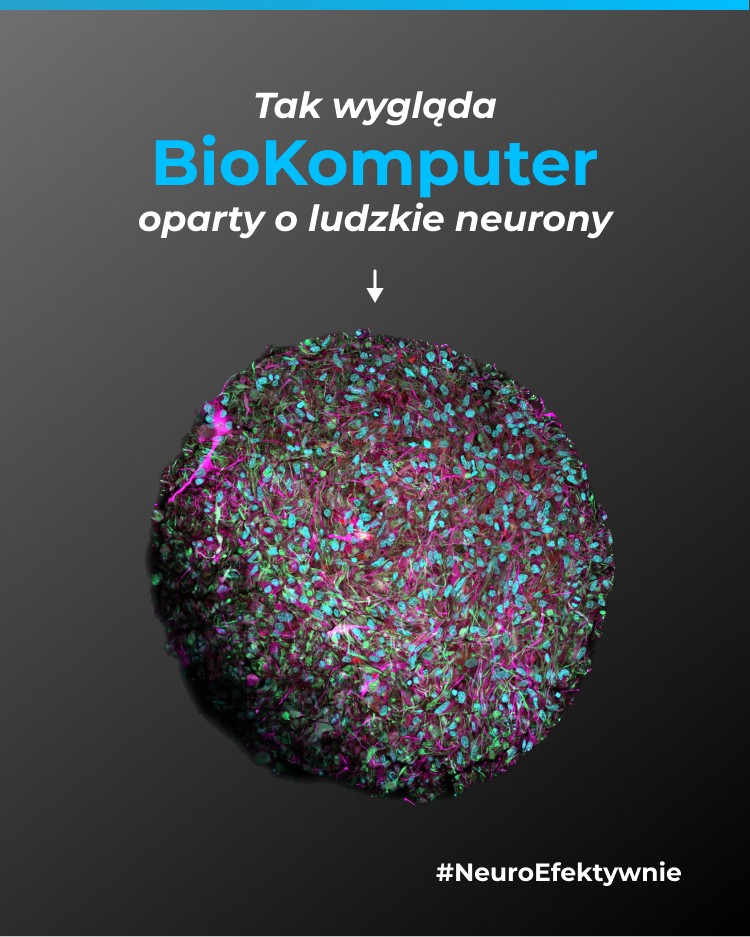 Biokomputer oparty na ludzkich neuronach - wizualizacja 3D organoidu neuronalnego z hodowanych komórek mózgowych wetware
