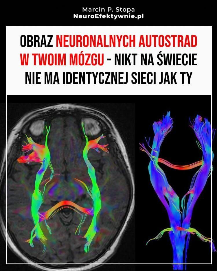 Obrazowanie DTI traktografia neuronalnych autostrad w mózgu - kolorowe szlaki połączeń istoty białej pokazane w przekroju mózgu i 3D