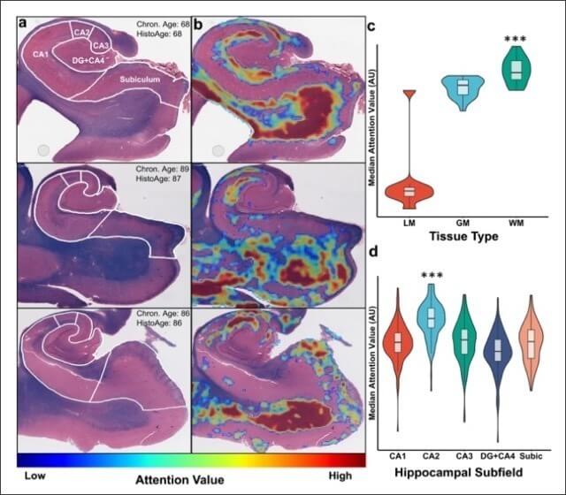 Porównawcze obrazy histologiczne hipokampu myszy w różnym wieku pokazujące mapy wartości uwagi oraz wykresy skrzypcowe analizy regionów CA1 CA2 CA3 DG CA4 i subiculum